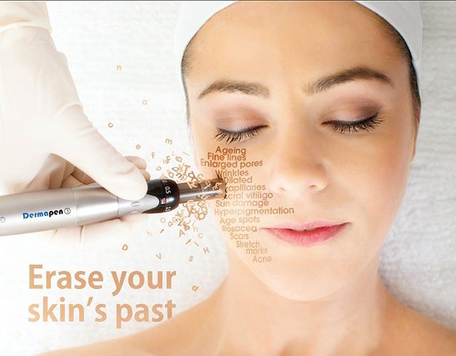 Skin Needling Paddington Best Skin Needling Treatment Skinnovation