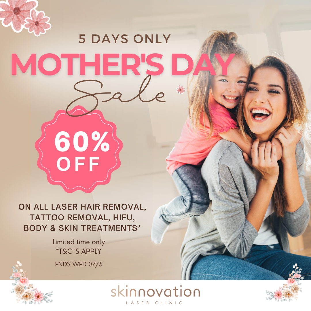 Mother's day Post Quadrado (1)