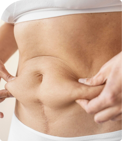 Body Sculpting 5 body sculpting5 1